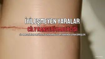 Cilt Kanseri Riski: İyileşmeyen Yaralar ve Güneş Maruziyeti Uyarıyor