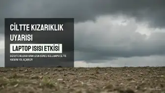 Uzun Süre Diz Üstünde Laptop Kullanımı Cilt Hasarına Yol Açabilir: 'Kızarmış Cilt Sendromu' Uyarısı