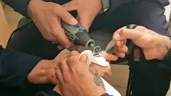 Amasya'da Parmağına Sıkışan Yüzük İtfaiye Tarafından Çıkarıldı