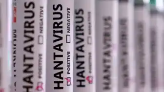 MV Hondius Gemisinde Hantavirüs Alarmı: Kaybolan Numuneler Üç Can Aldı