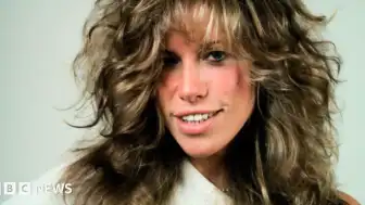Ünlü Şarkıcı Carly Simon Parkinson Hastalığı Teşhisi Aldığını Duyurdu