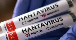 Hantavirüs Türkiye'ye Geldi mi? Sağlık Bakanlığı Açıklama Yaptı