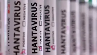 MV Hondius Gemisinde Hantavirüs Alarmı: Kaybolan Numuneler Üç Can Aldı